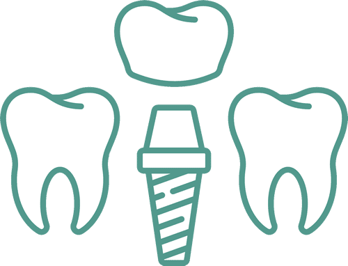 dental implant icon