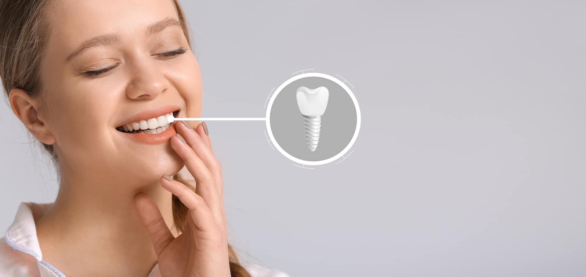 Exploring Dental Implants: Types, Candidates, FAQs, and La Crescenta, California
